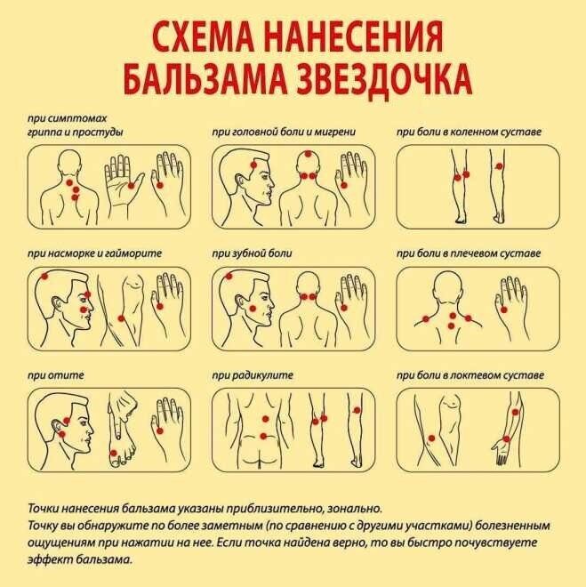 Схема-бальзам звездочка